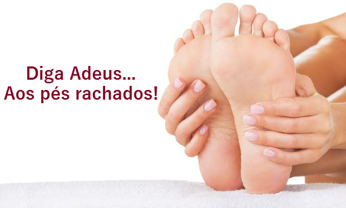 RemoFlex -Removedor de Calos -FootCare Pro™